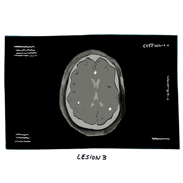 My MRI Comic 3